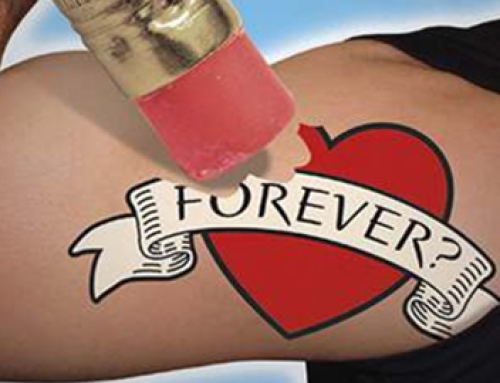 3 Reasons Dermatologists Add Tattoo Removal Alternatives